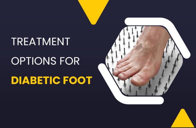 Treatment Options for Diabetic Foot